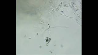 Release of Zoospores by Pythium sp [upl. by Ymled412]