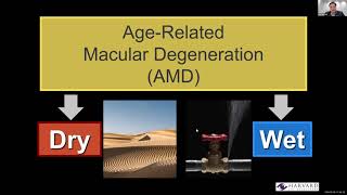 Agerelated Macular Degeneration AMD 2023 [upl. by Connie117]