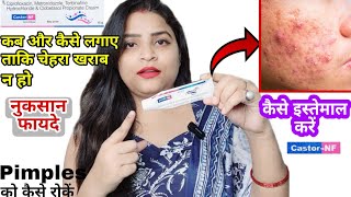 Castor NF skin cream How to use castor nf skin cream Pimple ko kaise roke [upl. by Harvison]