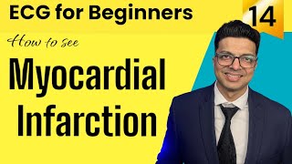 ECG for Beginners  How to see MYOCARDIAL INFARCTION in ECG  जानिए Evolution of MI in ECG [upl. by Aniles40]