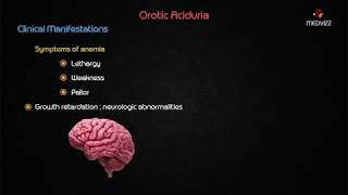 Orotic aciduria  Usmle biochemistry case based discussion [upl. by Rudyard497]