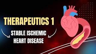 Therapeutics1  stable Ischemic Heart Disease [upl. by Avot]