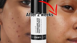 The Inkey List Tranexamic Acid Overnight Treatment Review with Results  How to use it [upl. by Adiehsar168]