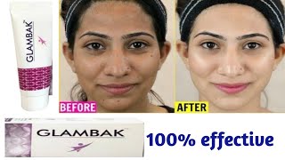 Glambak cream review  Kojic acid cream  सबसे अच्छी बिना किसी नुकसान के गोरा होने की क्रीम glambak [upl. by Otaner]