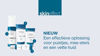 NIEUW De effectieve oplossing voor puistjes meeeters en vette huid  Skineffect onzuivere huid [upl. by Griggs692]