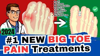 1 Big Toe Joint Pain Cure Arthritis Sesamoiditis Turf Toe Gout [upl. by Inanuah173]