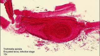 Trichinella spiralisEncysted larva [upl. by Amato]