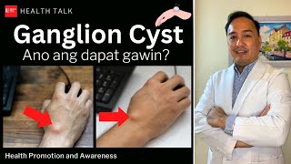 Ganglion Cyst Causes Risk factors Diagnosis Treatment and Prevention [upl. by Akahc]