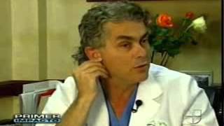 Andres Bustillo MD on Univision Primer Impacto for Medical RollCIT Collagen Induction Therapy [upl. by Nedyaj]