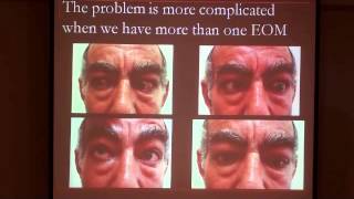 01 Orbital diseases Dr Ashraf ElDessoky [upl. by Gregorius]