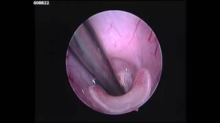 Safely intubating a rabbit before a surgical procedure [upl. by Hgielyk]