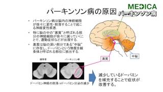 【MEDICA】「パーキンソン病」 川崎医科大学附属病院神経内科 三原雅史部長 [upl. by Noyart]