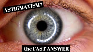 Astigmatism Explained in One Minute [upl. by Witte528]