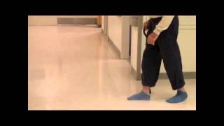 Right Foot Drop in Ambulating Patient  NEJM [upl. by Eillen790]