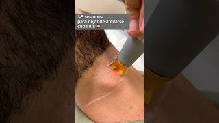 Cómo obtener una piel suave en el cuello con depilación depilación del cuello [upl. by Allana]