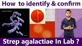 How to identify amp Confirm Streptococcus agalactiae [upl. by Amilas]