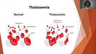 Management of Patients with Nonmalignant Hematologic Disorders Part II [upl. by Nehte468]