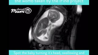 MRI Scan Video of Baby Moving in Womb  Channel Mum [upl. by Khalil808]