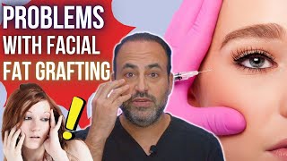 Problems with Facial Fat Grafting  Dr Ben Talei  Beverly Hills Plastic Surgeon [upl. by Keyes701]