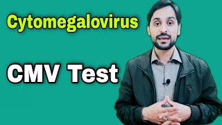 CMV Test  Cytomegalovirus Test [upl. by Udall]