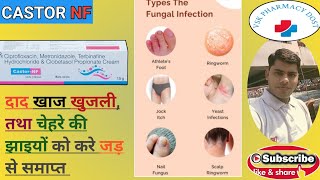 Castor NF Cream Full Hindi Review [upl. by Dosh]