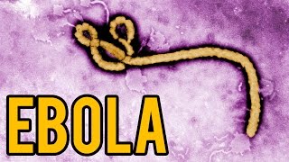 EBOLA il virus spiegato in 2 minuti e mezzo [upl. by Arodaeht]