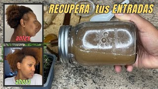 REMEDIO PARA HACER CRECER EL CABELLO DE LAS ENTRADAS Cómo Recuperar las Entradas mujeres y hombres [upl. by Boru]