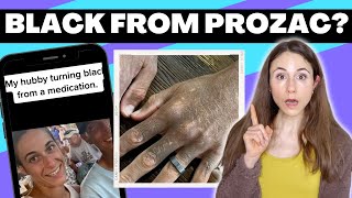 TIKTOK MANS SKIN TURNS BLACK AFTER PROZAC 😳 DERMATOLOGIST REACTS [upl. by Anaujd]