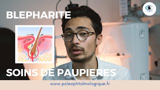 Blépharite  soins de paupières  Pole Ophtalmologique [upl. by Erhart]