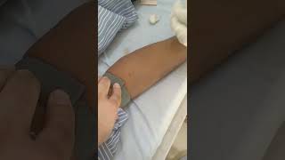 Intravenous canula insertion procedure [upl. by Murdock821]