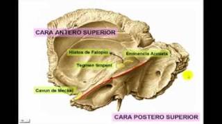 Osteología del Craneo parte 4 hueso temporal [upl. by Nahtanaoj]