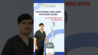 Fractional CO2 Laser For Acne Scars  Say Goodbye To Acne Scars [upl. by Clayborn972]