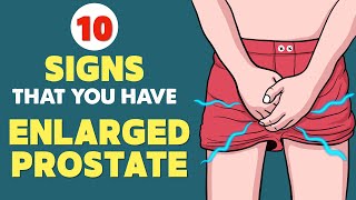 Enlarged Prostate BPH  Signs amp Symptoms  Every Man Needs to Know This [upl. by Enert983]