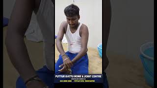 elbow dislocation treatment  முழங்கை மூட்டு விலகல்  vadapalani  puttur kattu [upl. by Anyahs309]