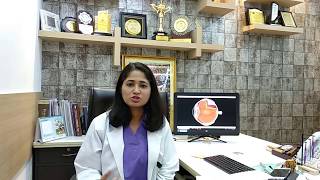 Age Related Macular Degeneration in Hindi  Age Related Macular Degeneration Treatment [upl. by Nilram]