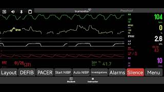 Pulseless Electrical Activity [upl. by Ahsi]