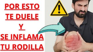 🦵 QUÉ PROVOCA EL DOLOR LÍQUIDO E INFLAMACIÓN DE RODILLA ✅REPASO DE LAS CAUSAS MÁS COMUNES [upl. by Aicekan70]