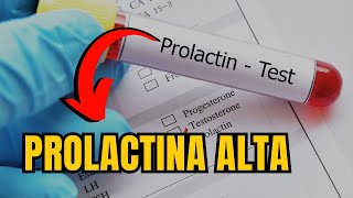 PROLACTINA ALTA QUAIS OS SINTOMAS QUAIS AS CAUSAS COMO TRATAR [upl. by Lenard]