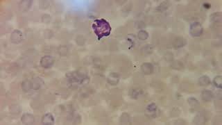 Trypanosoma cruzi Trypomastigote [upl. by Auliffe]