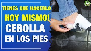 ✅Vas A Ponerte 1 CEBOLLA🍥 En Los PIES Mientras Duermes⚠️ Al Ver Lo Que Hace ¡Es LOCO😵Pero HAZLO [upl. by Llezom659]