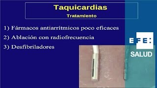 Tratamiento de las arritmias de taquicardia fármacos ablación y desfibrilador [upl. by Emelyne]