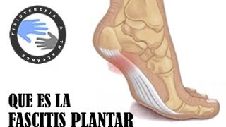 Fascitis plantar que es y como se produce [upl. by Russon784]