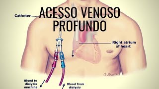 Acesso venoso profundo  Rotina na medicina de emergência [upl. by Zeitler282]