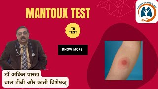 Mantoux Test मंटौक्स टेस्ट or Tuberculin Skin Test I डॉ अंकित पारख बाल टीबी और छाती विशेषज् [upl. by Esila]