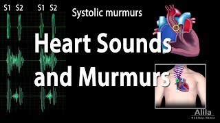 Heart Sounds and Heart Murmurs Animation [upl. by Darsie548]