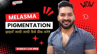 झाइयाँ जल्दी जल्दी कैसे ठीक करे How to fix Melasma amp Pigmentation quickly Sunday Live 88 [upl. by Rialcnis]