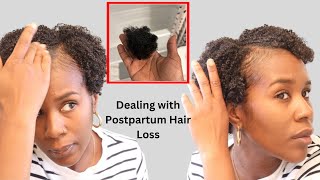 My Postpartum Hair Loss Journey  9 Tips on How to Care for Your Hair taperedcut postpartum [upl. by Moreland97]