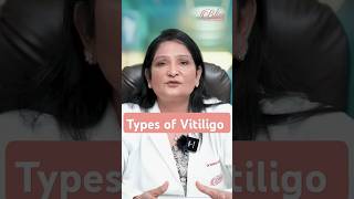 Types of Vitiligo  Vitiligo skin disease  Vitiligo Treatment in Ludhiana [upl. by Veno]