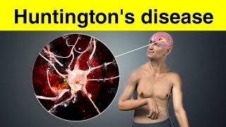 Huntingtons disease क्या है [upl. by Adigun]