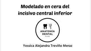 MODELADO EN CERA DEL INCISIVO CENTRAL INFERIOR [upl. by Necaj]